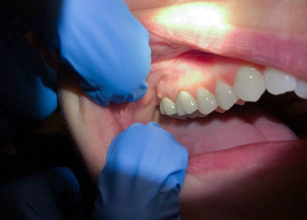 Best Emergency Dental Surgery in Dover Beaches North, NJ
